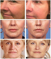 Anti Aging Remove Wrinkle Serum Lifting Brighten-BH00203-Veeddydropshipping